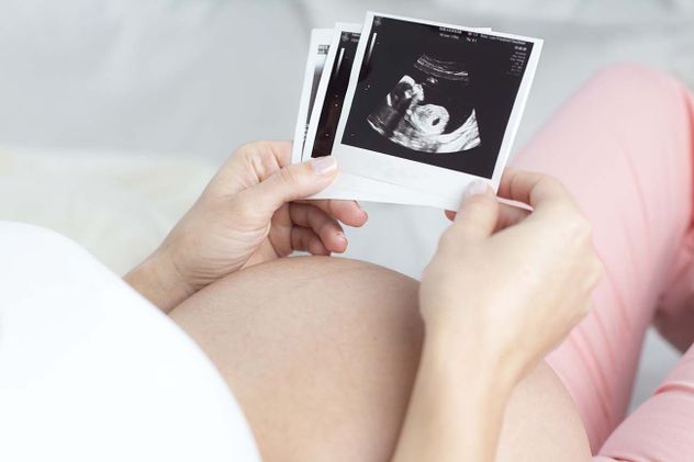 La falta de acceso a controles y a la salud materna es uno de los factores de riesgo de muerte materna más mencionados