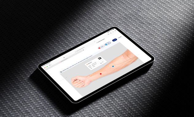 Veristra registra los puntos de acceso de las cánulas en pacientes bajo tratamiento de diálisis