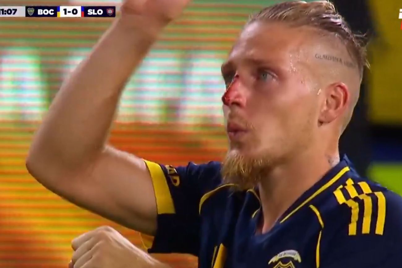 El rostros con sangre de Santiago Ascacibar luego de su festejo en el 1-0 de Boca ante San Lorenzo. 