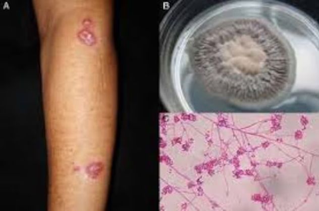 Hongo peligroso en gatos: qué es la esporotricosis y cómo prevenir el contagio.