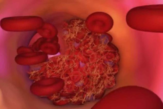 El colesterol LDL debe mantenerse bajo límites más estrictos según el nivel de riesgo.