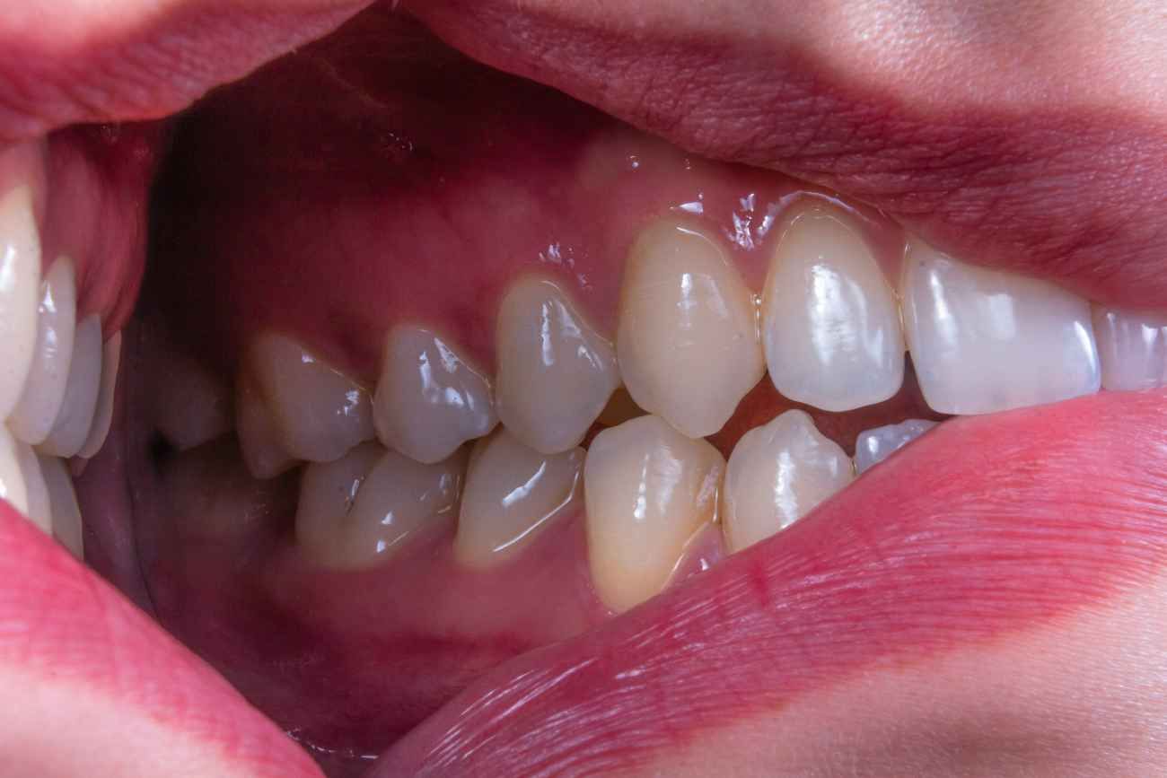 La salud bucodental es una parte muy importante de la salud en general: tener la boca, los dientes y las encías sanas son aspectos claves para una vida saludable.