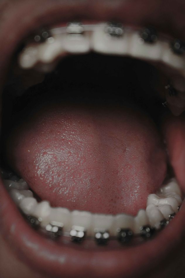 La salud bucodental es una parte muy importante de la salud en general: tener la boca, los dientes y las encías sanas son aspectos claves para una vida saludable.