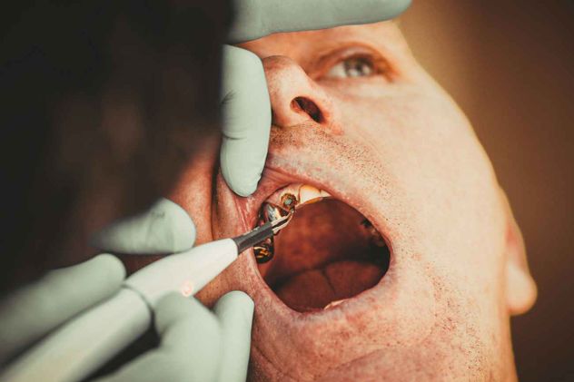 La salud bucodental es una parte muy importante de la salud en general: tener la boca, los dientes y las encías sanas son aspectos claves para una vida saludable.