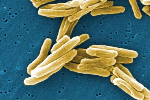 Tuberculosis en alza: los casos crecieron casi 4% en 2025 y se concentran en el centro del país.