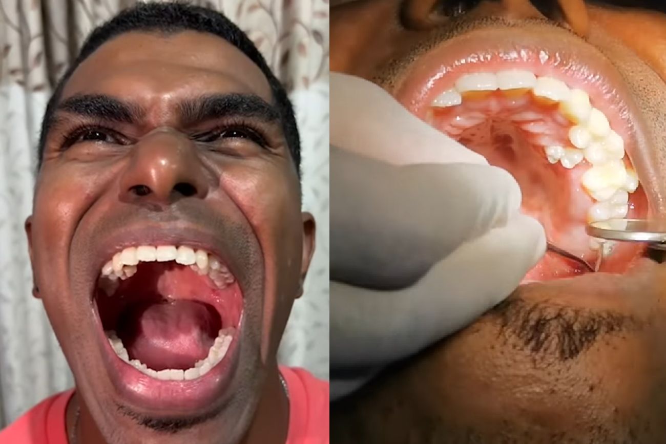Tiene 42 dientes.
