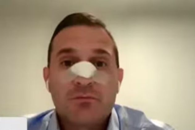 El diputado Federico Pelli fue operado tras recibir un cabezazo y no descarta una nueva cirugía
