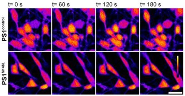 Este caso es un avance significativo porque permitió reproducir neuronas humanas en laboratorio. 