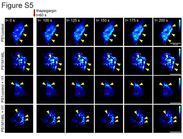 Fotografía obtenida por microscopía de fluorescencia. Las flechas señalan el contenido de calcio mitocondria en neuronas humanas, obtenidas por diferenciación de células madre pluripotentes inducidas. 