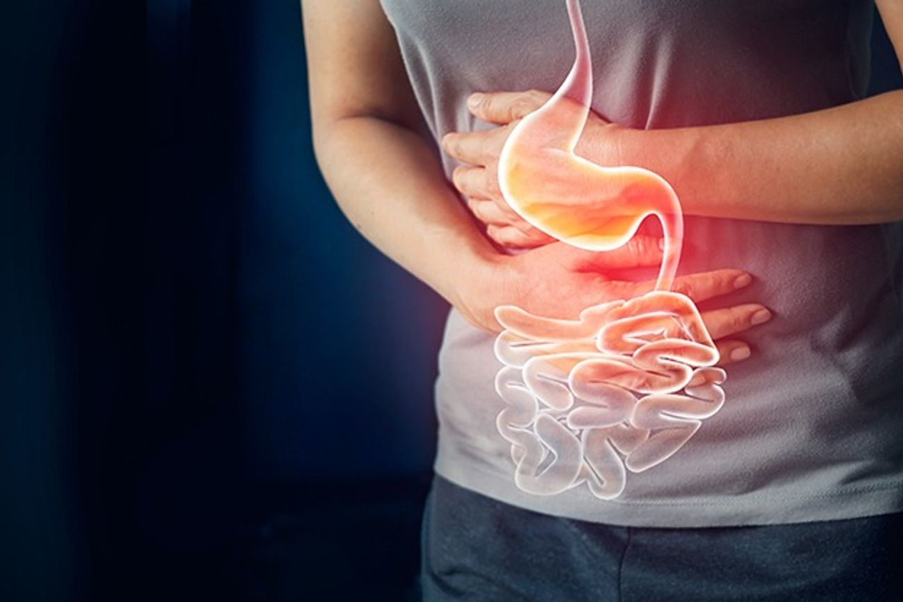 Síndrome del intestino irritable: cuánto dura una crisis y síntomas.