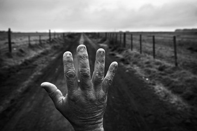 8- Alfredo Cerán, antiguo aplicador de pesticidas, muestra sus uñas quemadas en Córdoba, Argentina. Tras años de manipular químicos sin protección, desarrolló cirrosis no alcohólica y requirió un trasplante de hígado.