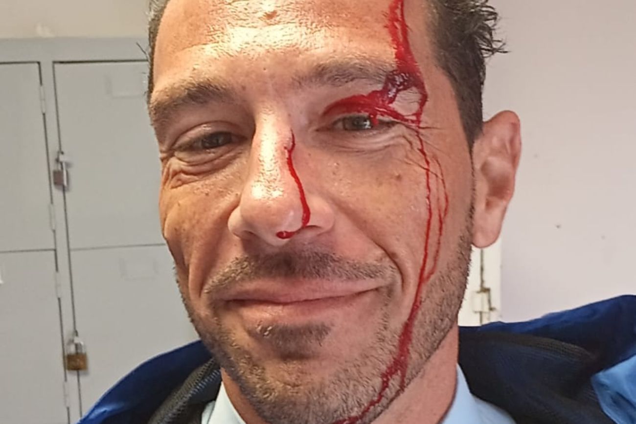 Así quedó el rostro del chofer agredido en el barrio Nuestro Hogar 3.