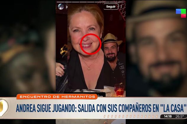 Así está Andrea del Boca tras su caída en "Gran Hermano".