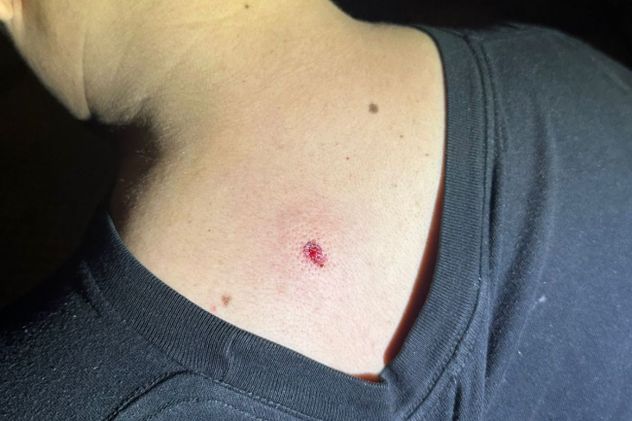 Un repartidor recibió un impacto de balín en la espalda, a centímetros del cuello.