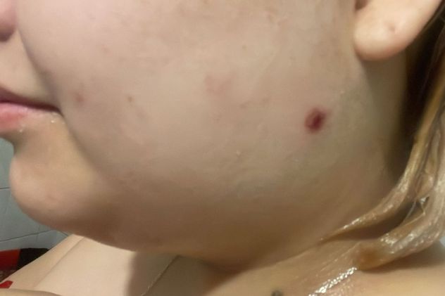 Dos estudiantes siguen acusados de disparar balinazos desde un balcón en Nueva Córdoba: hirieron al menos a dos personas.