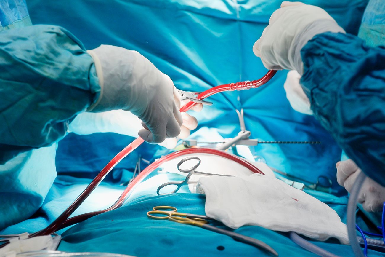 Anmat sacó de circulación insumos vinculados con la cirugía cardiovascular. 