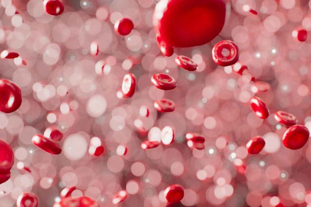 La beta talasemia es un trastorno sanguíneo hereditario frecuente, caracterizado por una síntesis defectuosa de hemoglobina. 