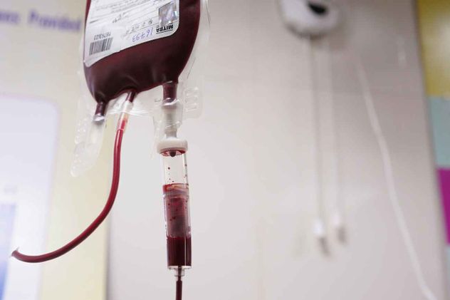 La beta talasemia es un trastorno sanguíneo hereditario frecuente, caracterizado por una síntesis defectuosa de hemoglobina. 