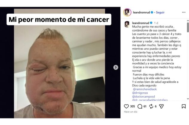 Leandro Rud compartió fotos de su tratamiento mientras batalla contra el cáncer.