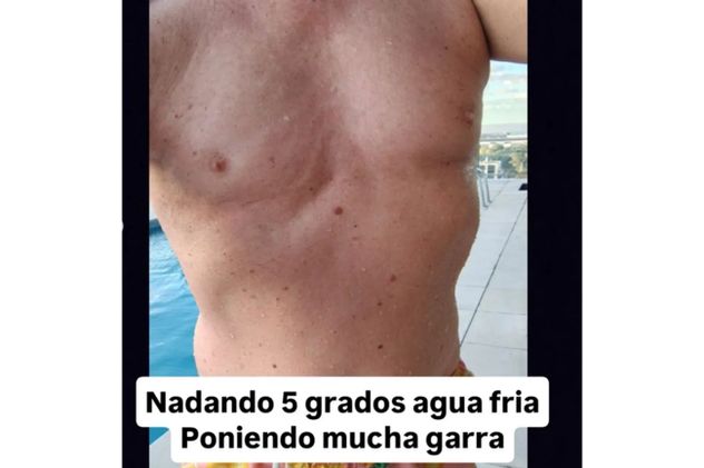 Leandro Rud compartió fotos de su tratamiento mientras batalla contra el cáncer.