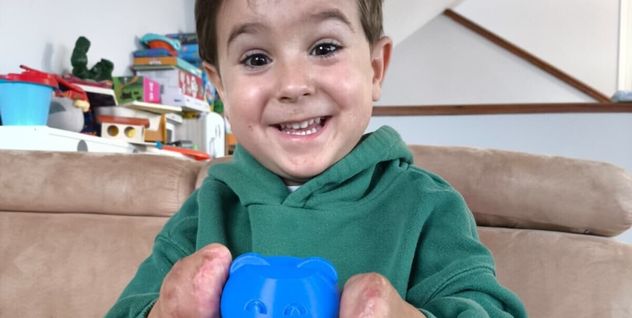 Mael, el niño al que le amputaron sus manos y pies tras luchar contra el “dragón del meningococo”.