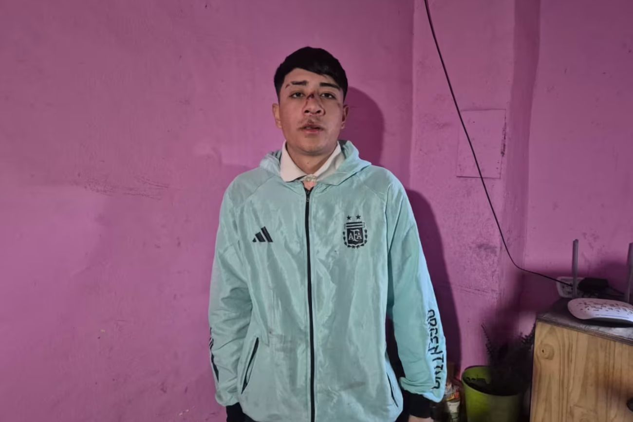 Córdoba: un joven denunció que fue golpeado por patovicas a la salida de un boliche