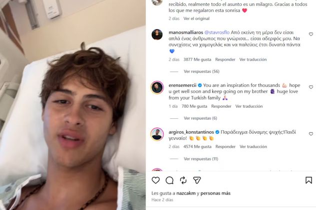 Quién es Stavros Floros, el concursante que sufrió la amputación parcial de una pierna en Survivor