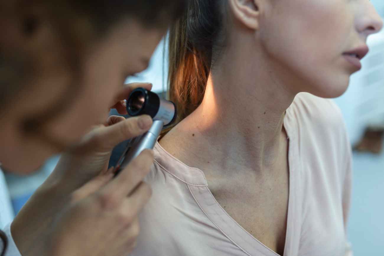 El Día Mundial del Melanoma se conmemora cada 23 de mayo. 