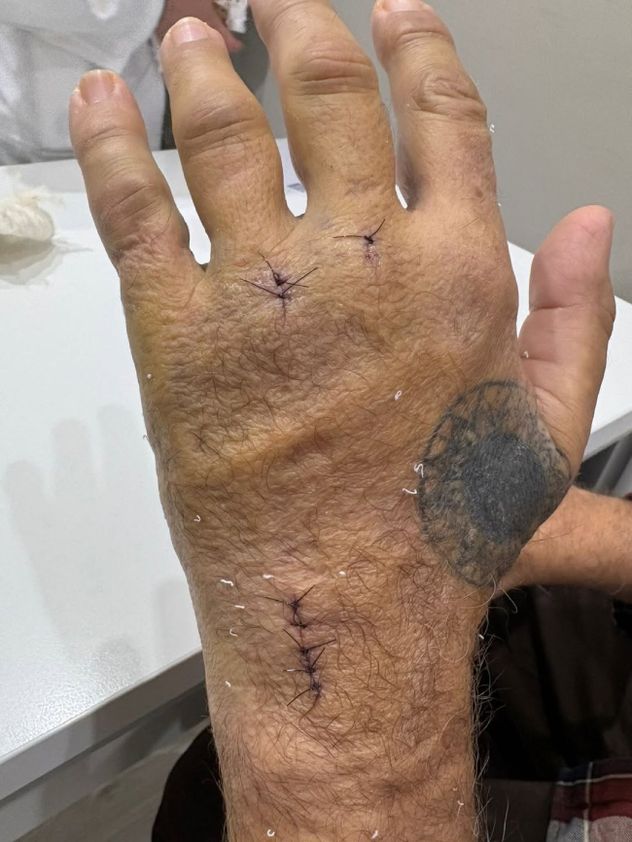 JaAsí quedó la mano de Javier Malosetti.