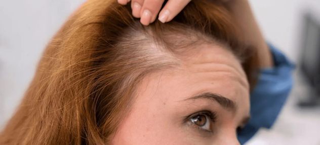 Qué hacer para frenar la caída del pelo, según un estudio de Harvard.