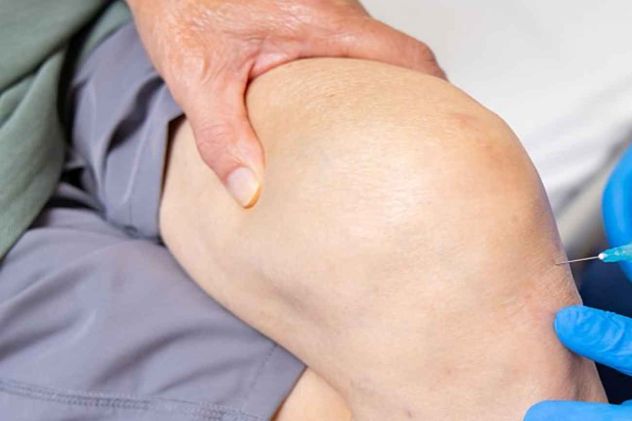 Artrosis de rodilla. 