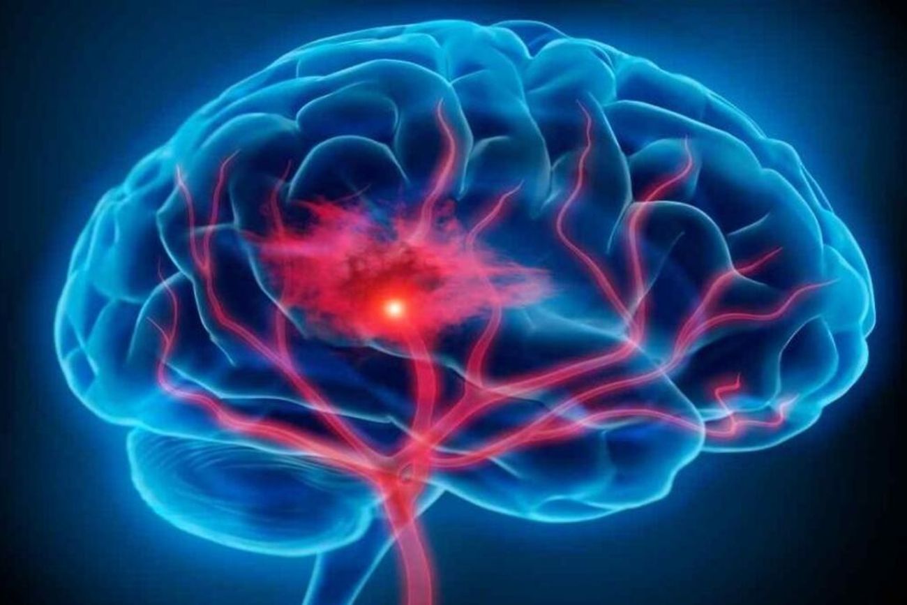 Cerebro (Imagen ilustrativa)
