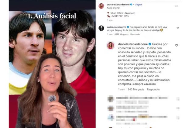 La respuesta de Antonela Roccuzzo a la esteticista que detalló en Instagram los supuestos retoques estéticos que se habría realizado Lionel Messi.
