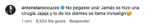 Qué es Invisalign, el tratamiento que usa Lionel Messi y que reveló Antonela Roccuzzo.