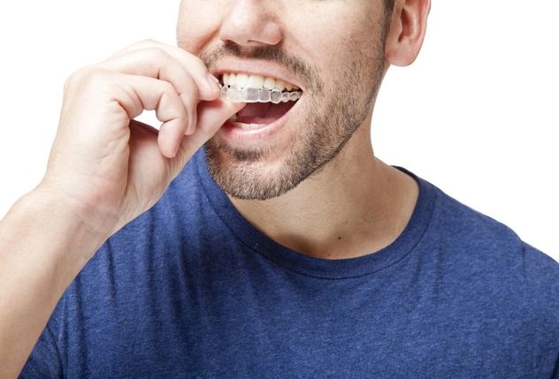 Qué es Invisalign, el tratamiento que usa Lionel Messi y que reveló Antonela Roccuzzo.
