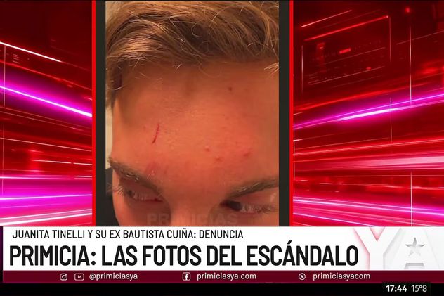 Las lesiones de Bautista Cuiña. Foto: captura pantalla.