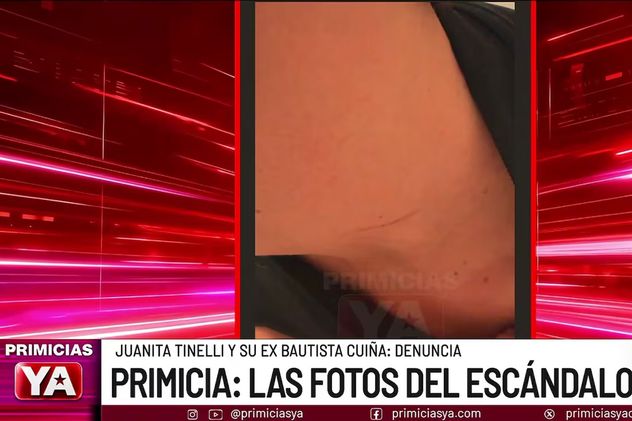 Las lesiones de Bautista Cuiña. Foto: captura pantalla.
