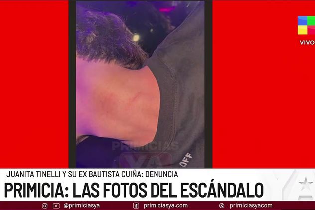 Las lesiones de Bautista Cuiña. Foto: captura pantalla.
