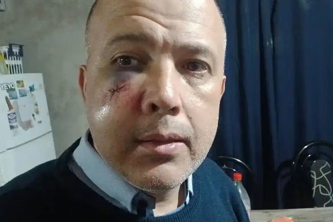 Pilar: un pasajero le fracturó la mandíbula a un colectivero porque no le abrió la puerta a tiempo