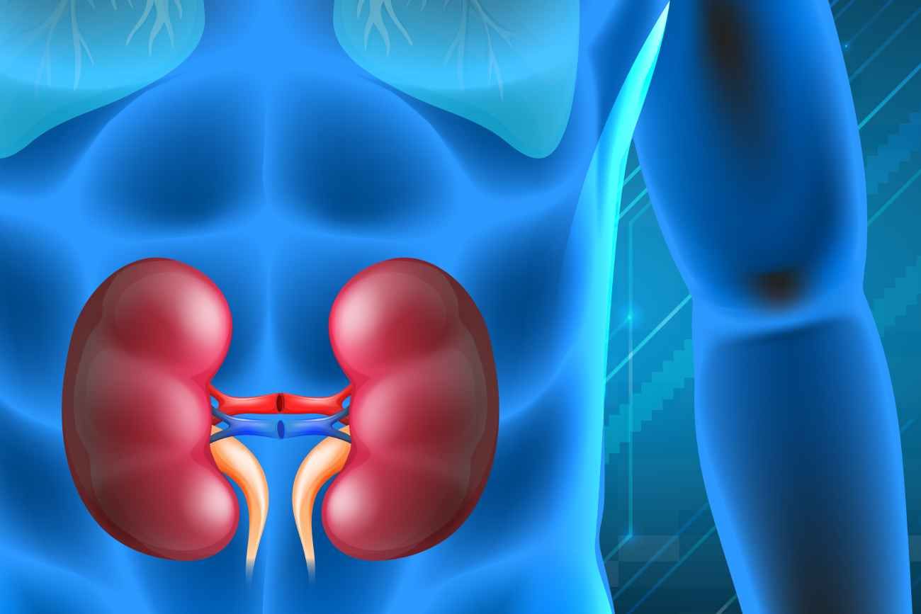 Cáncer de riñón.
