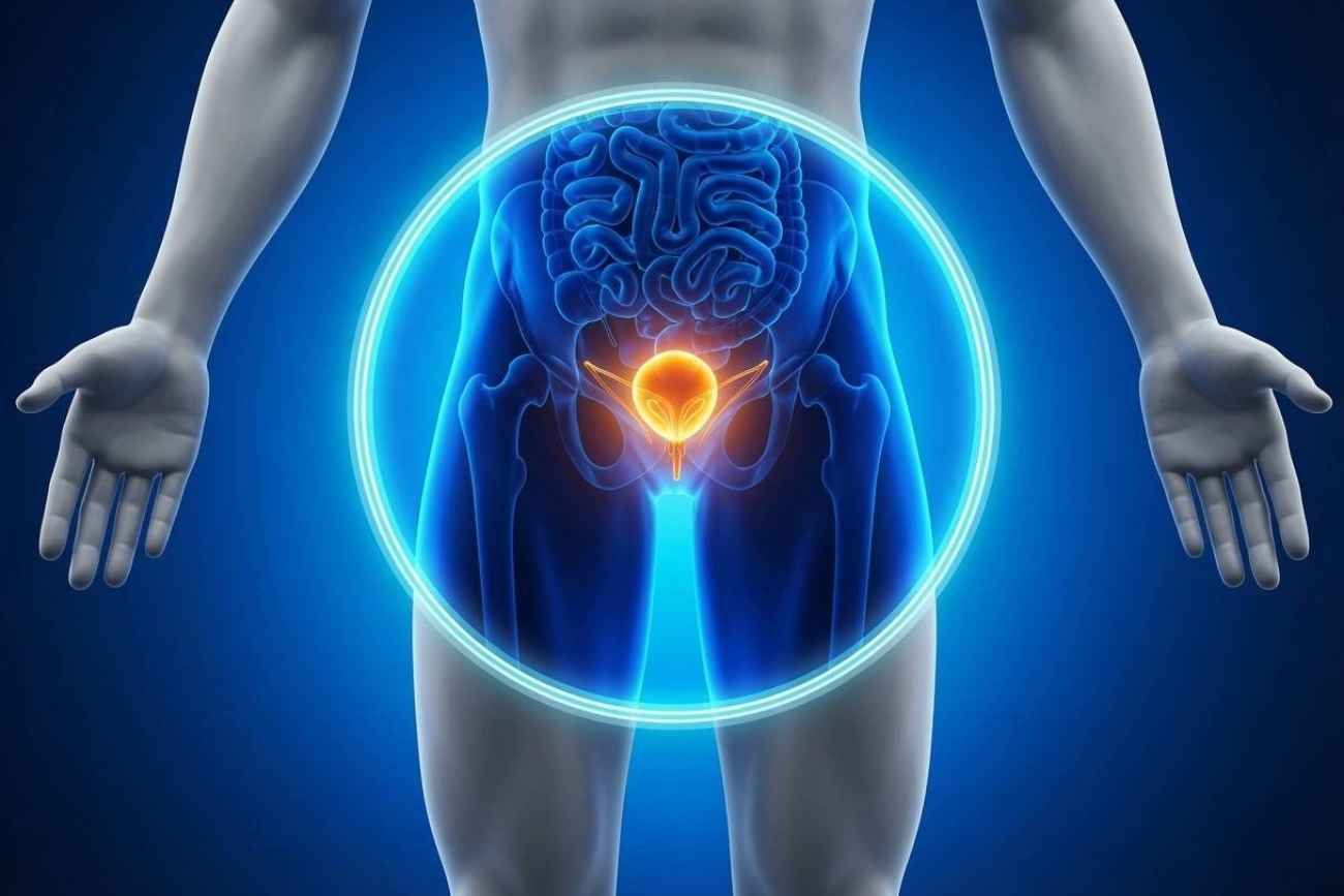 Cáncer de próstata. Uno de cada cuatro hombres lo padecerá alguna vez. 