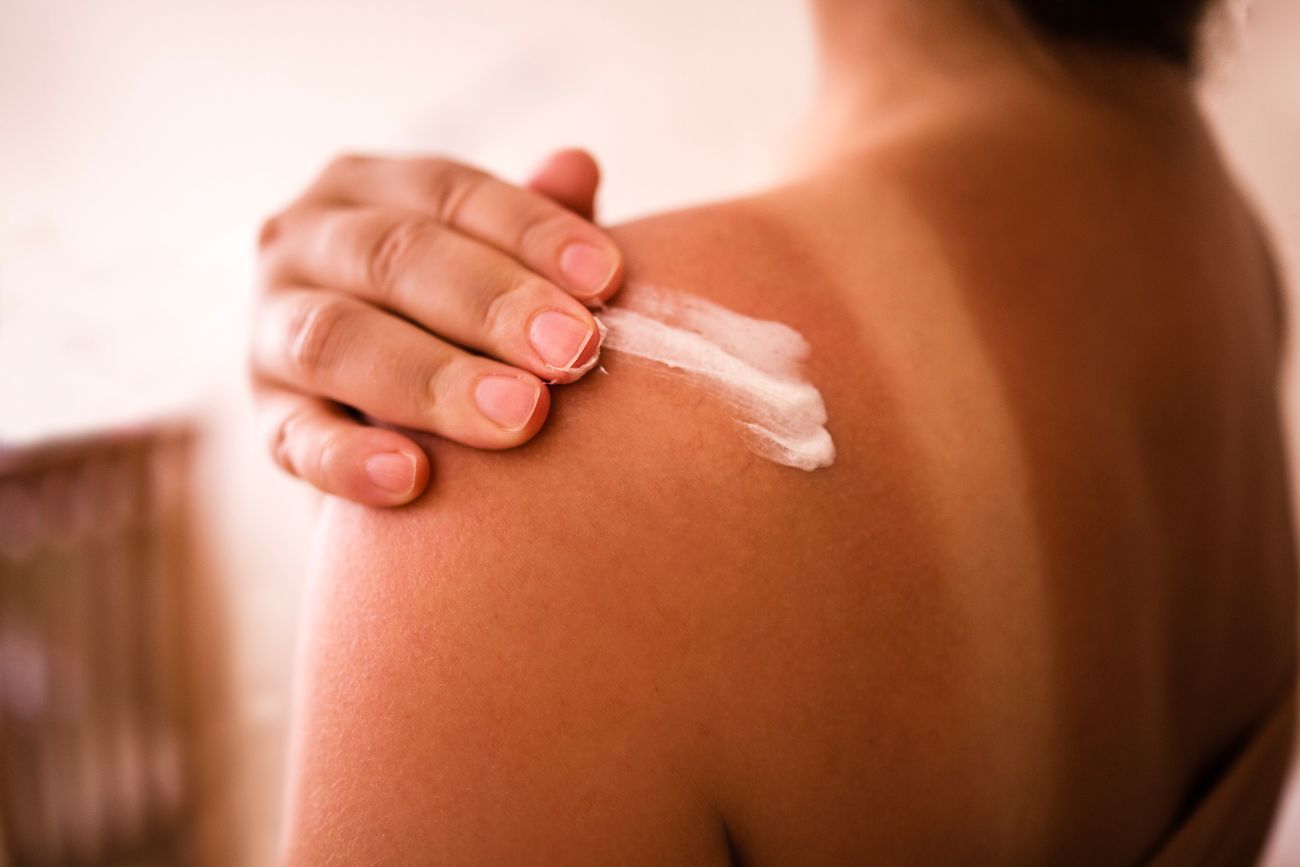 Crema, bronceado, piel, sol, quemadura, estética, cosméticos. Imagen ilustrativa.