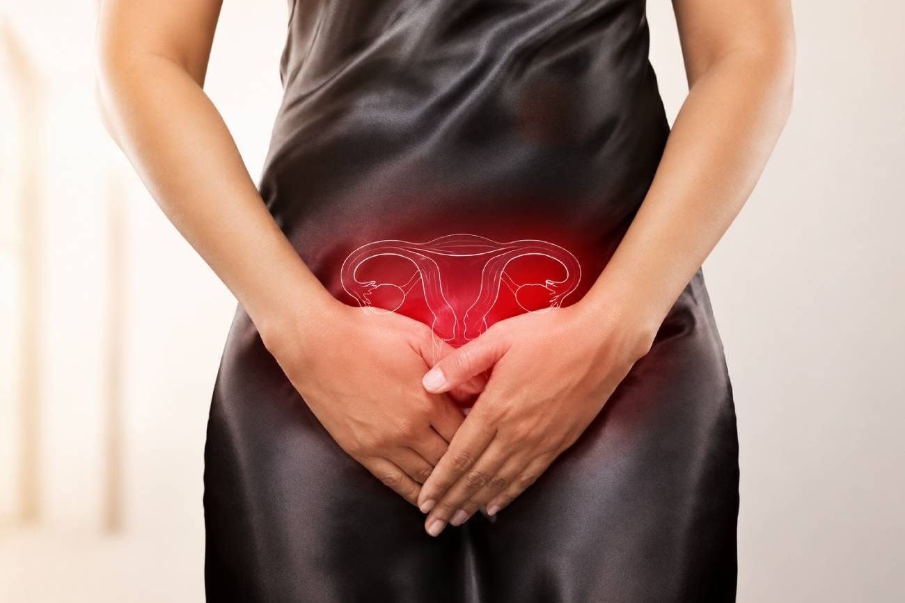 Agenesia vaginal: qué es.