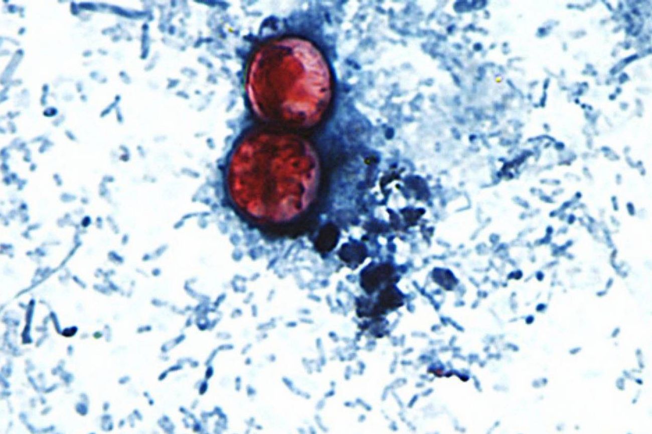 Ciclosporiasis. El parásito Cyclospora cayetanensis ingresa al cuerpo humano por vía fecal-oral.