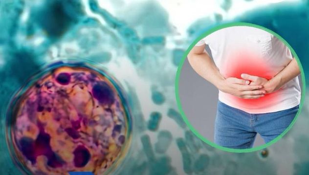 Qué es la ciclosporiasis.