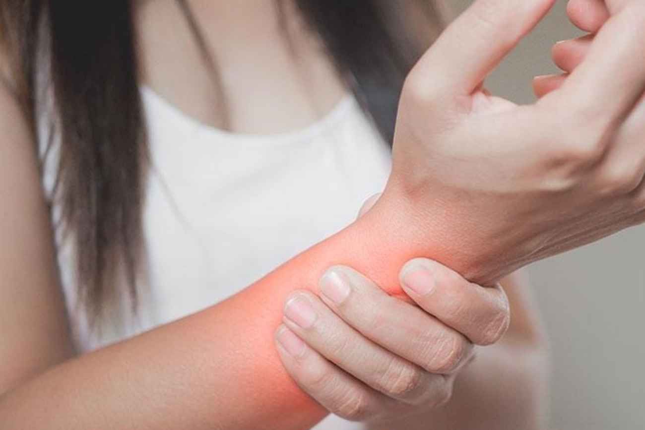 Artritis psoriásica. 