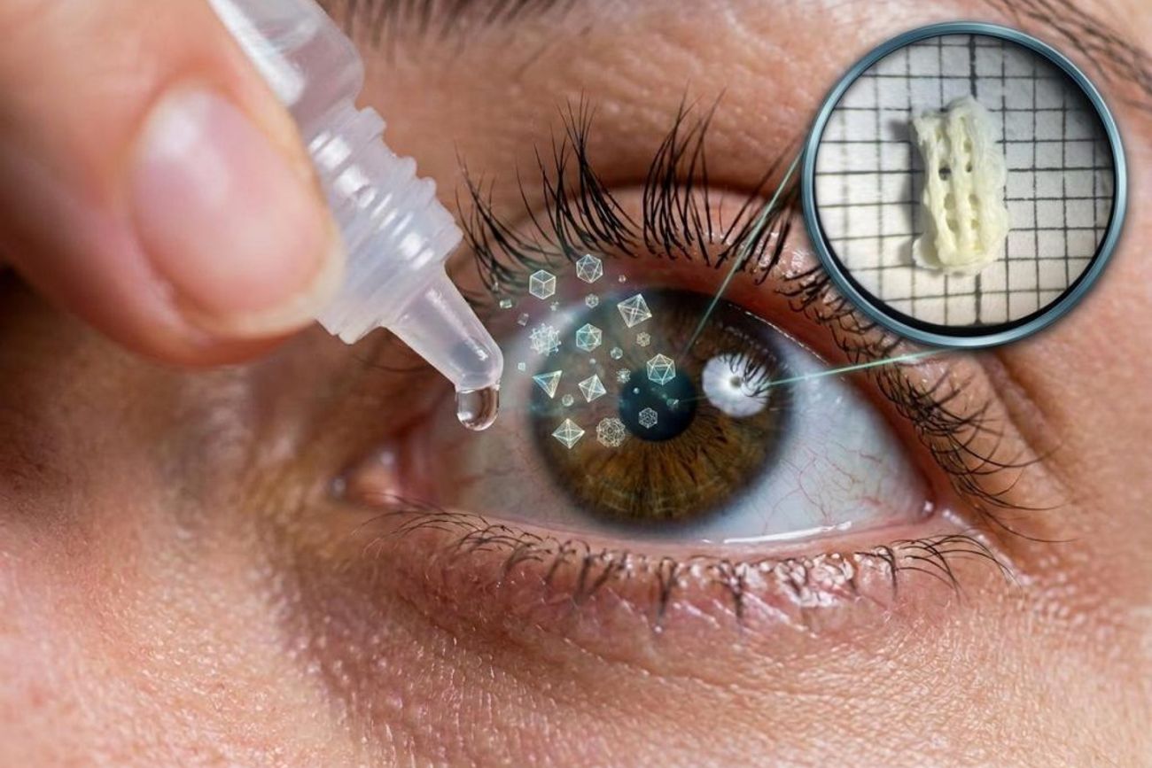 Parches oculares con impresión 3D para el tratamiento del galucoma. 