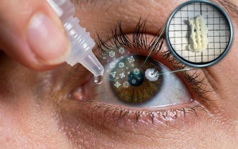 Parches oculares con impresión 3D para el tratamiento del galucoma.