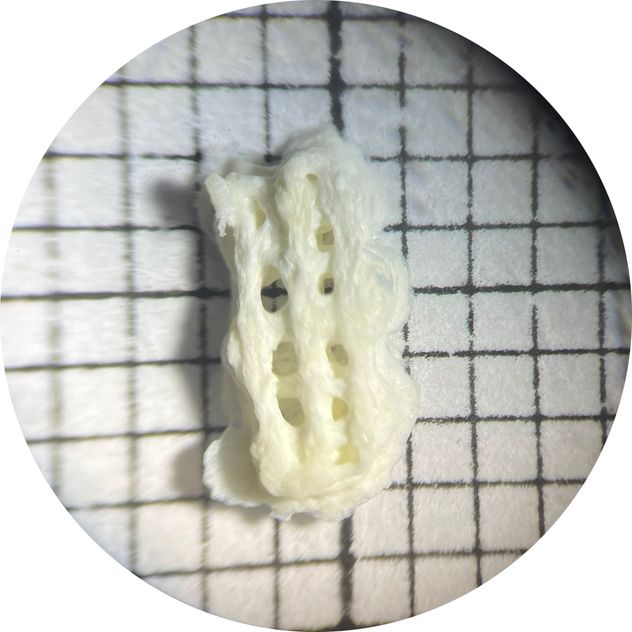 Parches oculares con impresión 3D para el tratamiento del galucoma.