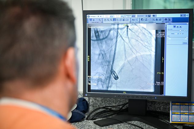 Por primera vez en la salud pública provincial se llevó a cabo una angioplastia coronaria